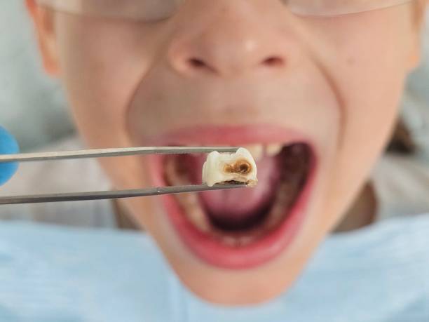 Best Knocked-Out Tooth Emergency  in Glendale Heights, IL